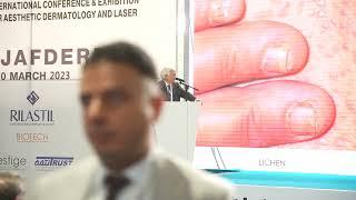 Nail psoriasis Differential Diagnosis Dr. Nejib Doss | 4th Najaf Derma 2023