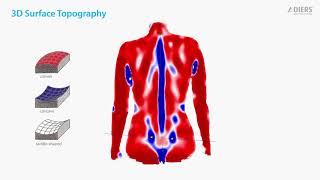 DIERS formetric 4D - How it works EN 1