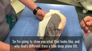 Deep Plane Facelift Demonstration & Explanation (Nongraphic)