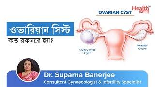 ওভারিয়ান সিস্ট - কারণ, লক্ষণ ও চিকিৎসা কি? | Ovarian Cyst - Causes, Symptoms, Types & Treatment