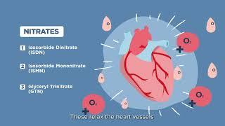 A Cardiac Rehabilitation Journey with A Pharmacist