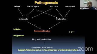 Surgical Procedures in Endometriosis | Techniques, Challenges & Management | 26th Dec 2020 Webinar