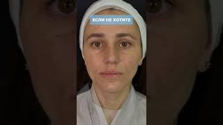 #косметолог #акне #лифтингмосква #москва #фейсбилдинг #уход #botox #уходзажирнойкожей #ботокс