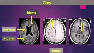 Imaging characteristics of various tissues on T1W MRI