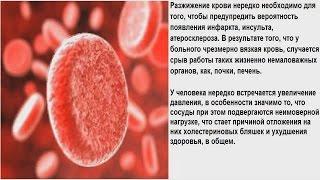 ПРОФИЛАКТИКА ОБРАЗОВАНИЯ ТРОМБОВ ПОЛЕЗНЫЕ СОВЕТЫ