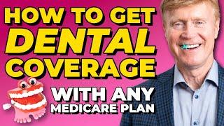 Does Medicare Cover Dental? How To Get Coverage With Any Plan! 