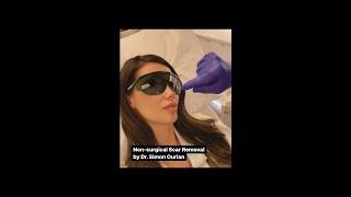 Scar Removal by Dr  Simon Ourian