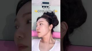 효과 100%보장 목주름 없애는 방법 3단계목주름 스킨보톡스 효과!#목주름