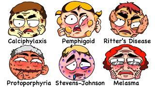 Every Skin Disorder Explained In 19 Minutes