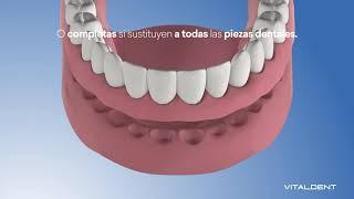 Prótesis Dental Removible - Vitaldent