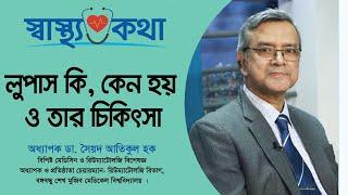 লুপাস কি, কেন হয় ও তার চিকিৎসা