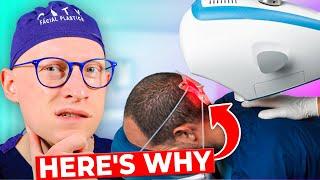 Why I DON'T Use a Hair Loss ROBOT