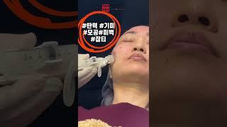 부작용이 적은 올인원 콜라겐 주사 #올인원콜라겐주사 #콜라겐주사 #콜라겐 #콜라겐부스터 #피부탄력 #주름개선
