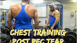 Chest Training after the Pec Tear | New Strategies