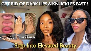 Get Rid of Dark Lips and Blend Uneven Hands | Treat Your Beauty & Hygiene like a Level Up Project