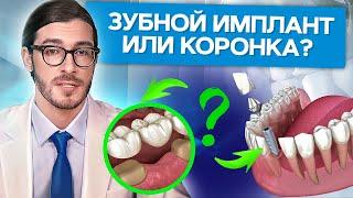 Зубной имплант или коронка? Что лучше выбрать зубной имплант или коронку?
