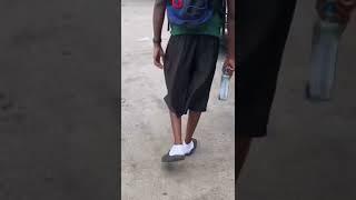 Oblock Members Goofing Round In Da Hood️ #chiraq #oblock #fbg #lildurk #viral #goofy #hoodcomedy