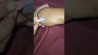 iv cannula proceed technique #part 13