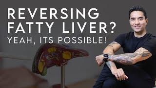 Using The Power Of Lifestyle To Reverse Fatty Liver