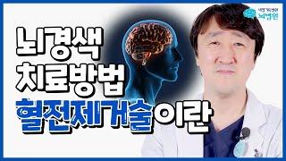 뇌경색 치료 약 vs 수술! 혈전을 제거하는 혈전제거술