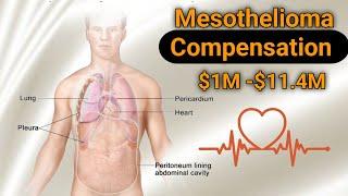 Largest Mesothelioma Settlement