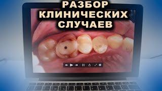 Новые клинические случаи. Работаю без медсестры