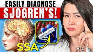 Sjogren's Disease: The Essential Tests You MUST Ask Your Doctor About