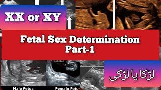 XX or XY _ Fetal Sex Determination Part-1 ️ | Boy or Girl #medical #ultrasound #pregnancy #shorts