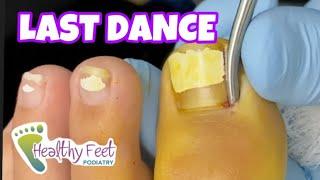 Leo's Last Ingrown Nail Removal