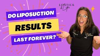 How long will liposuction results last?