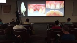 LIVE Recording from Spear Implant Restorative Dentistry Workshop Pt. 2