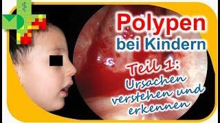 POLYPEN bei Kindern - Teil 1