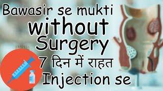 Sclerotherapy injection for piles | bawasir ka ilaj | piles treatment without operation