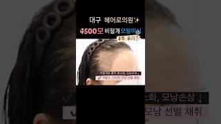 모발이식 Before & After2주 경과ㅣ헤어로의원 대구점ㅣ