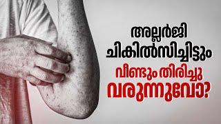 മാനസികാരോഗ്യം അല്ലർജിയെ ബാധിക്കുമോ?| Allergy | Recurring Allergy Causes | Allergy Treatment | Health