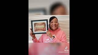 Watch This Smile Transformation!  Implants + Porcelain Crowns Before & After