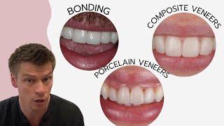 Bonding, Composite Veneers Or Porcelain Veneers With Jamie