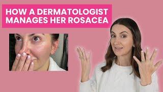 How a Dermatologist Manages Her Rosacea | Dr. Aleksandra Brown's Skincare & Treatment Plan