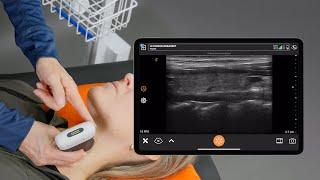 Anatomy of an Ultrasound Image