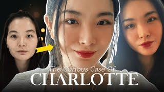 Charlotte's PLASTIC SURGERY journey at BRAUN (Part 2) (Facial contouring,  double eyelid surgery)