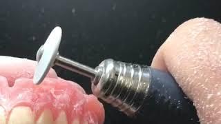 Denture Finishing