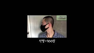 Hair Growth in 100 days(from shaving to now) [YWN] #shorts