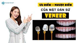 Ưu nhược điểm của mặt dán răng sứ veneer | nha khoa Hân Đào