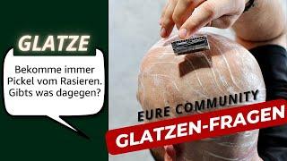 GLATZE Rasieren 🪒 Pflege: Ich beantworte Eure GLATZEN-Fragen aus der Community | BETTER BE BOLD