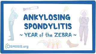 Ankylosing spondylitis (Year of the Zebra 2024)