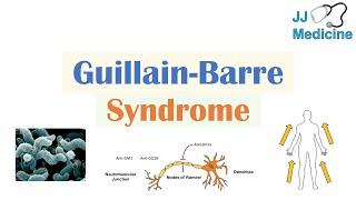 Guillain-Barré Syndrome (GBS) | Causes, Pathophysiology, Signs & Symptoms, Diagnosis, Treatment