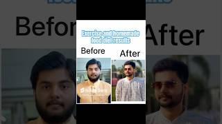 My face fat loss #ytshorts #funny #fatburningsecrets #weightloss #facefat #funny #motivation