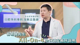 All-On-4 全口速定植牙｜沈炯志 口腔外科醫師 治療計畫說明｜李宜昇牙醫診所 台中植牙推薦