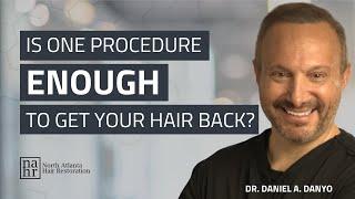 Is One Procedure Enough to Get Your Hair Back?