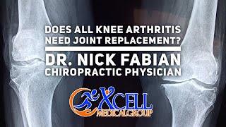 Does all Knee Arthritis Need Joint Replacement?